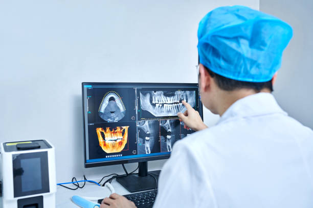 Best Emergency Dental Extractions in Clifton, TN